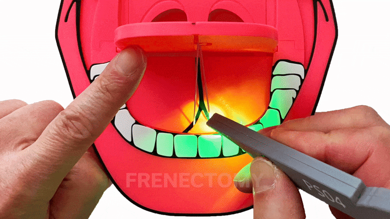 the Mouth + laser trainer (pre-order)